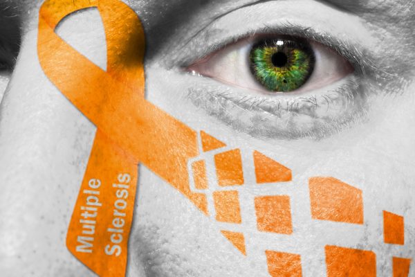 Racun Dari Bakteri Usus Dapat Memicu Multiple Sclerosis, Studi Menyarankan